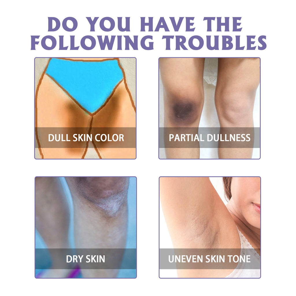 Oceaura Beauty Moisturizer, Elbow Joint Underarm Dull Brightening Skin Moisturizing And Whitening Skin