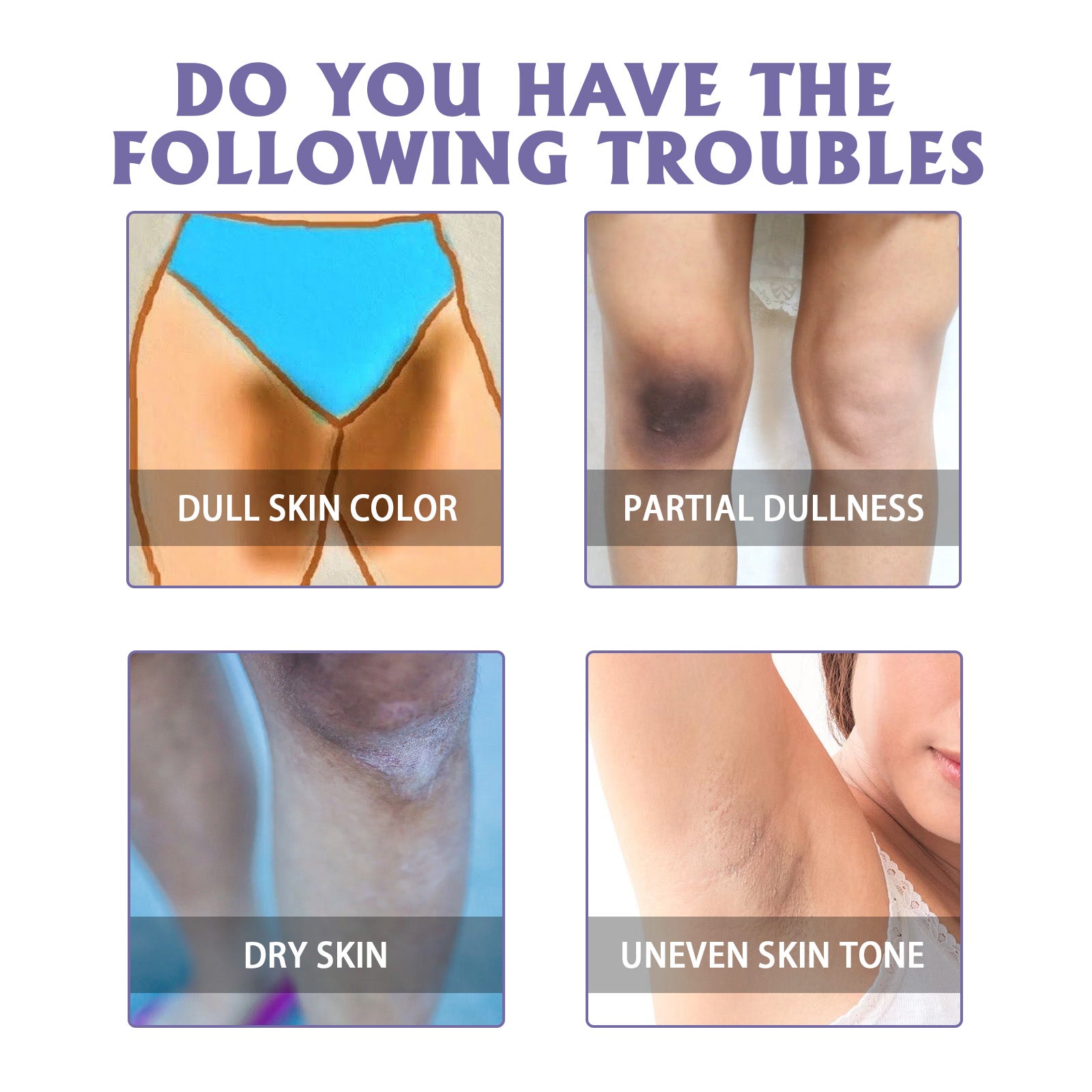 Oceaura Beauty Moisturizer, Elbow Joint Underarm Dull Brightening Skin Moisturizing And Whitening Skin