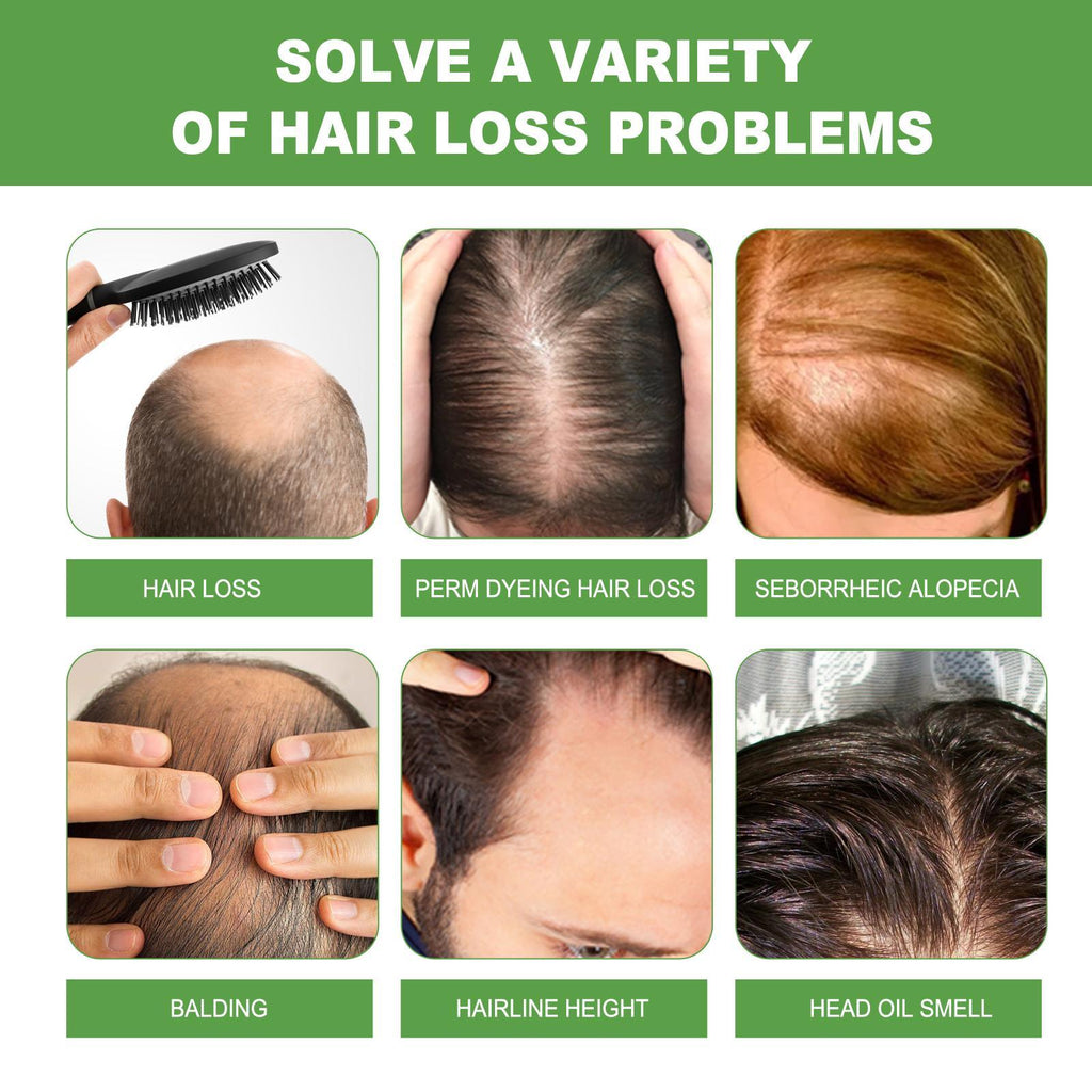 Iluxuan Rosemary Shampoo Deeply Cleanses The Scalp, Moisturizes, Smooths, And Thickens Hair.