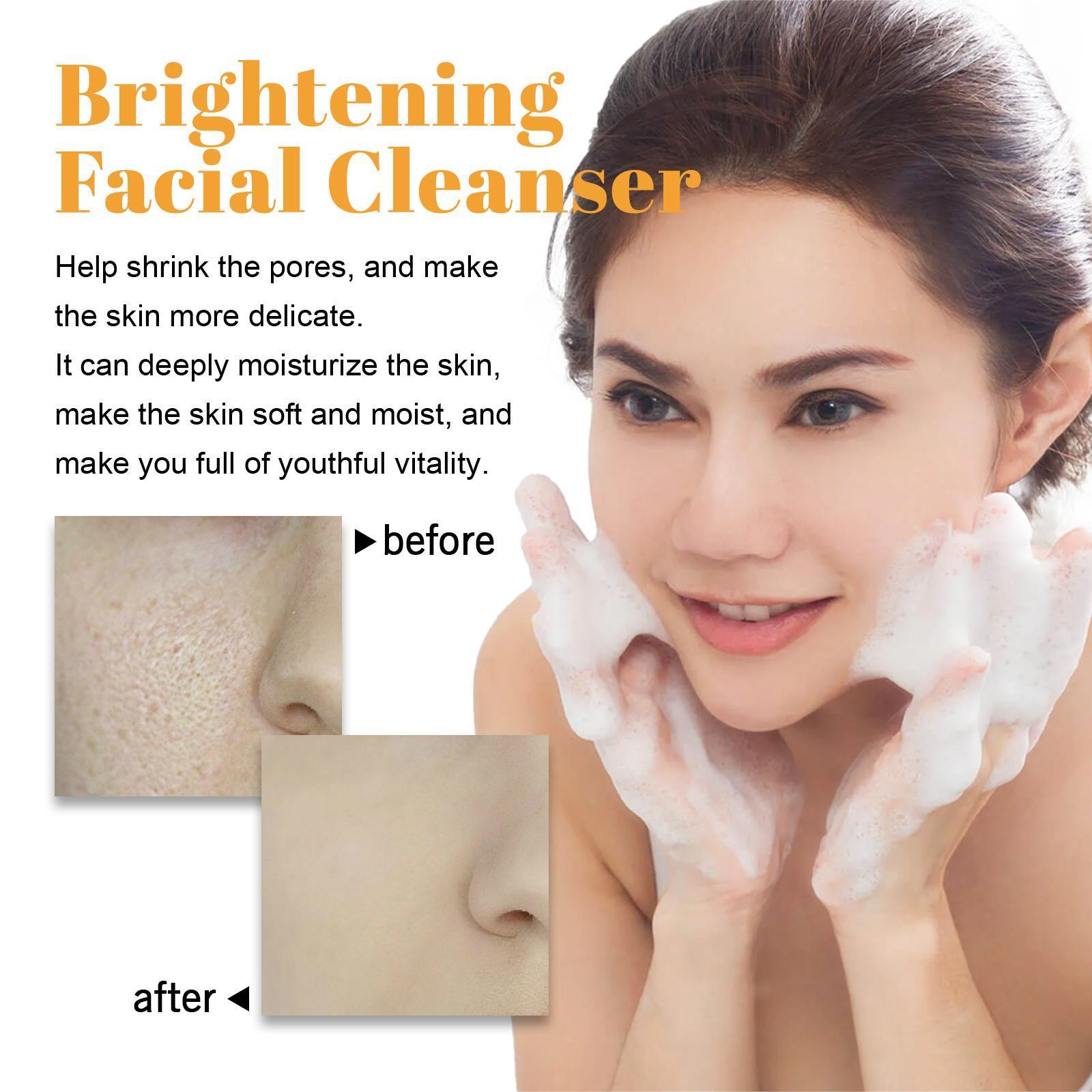 Hoijji Brightening Facial Cleanser, Deep Cleansing Facial Skin, Fades Acne Marks, Moisturizes And Whitens