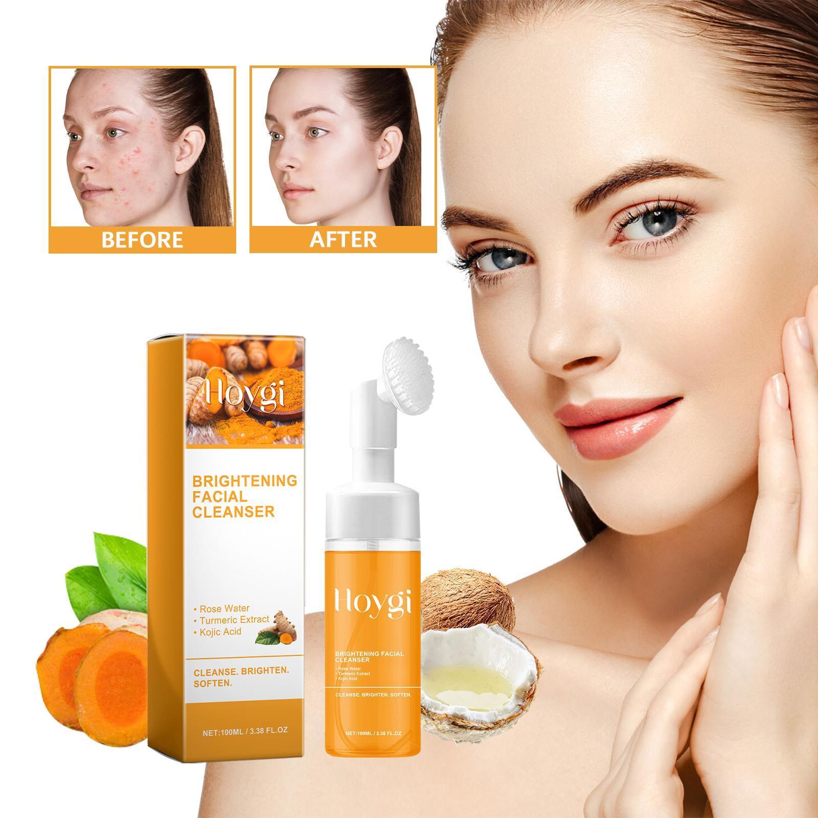 Hoijji Brightening Facial Cleanser, Deep Cleansing Facial Skin, Fades Acne Marks, Moisturizes And Whitens