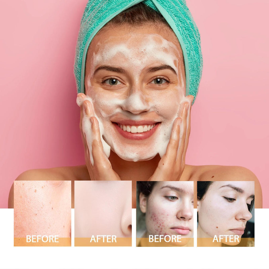 Hoijji Brightening Facial Cleanser, Deep Cleansing Facial Skin, Fades Acne Marks, Moisturizes And Whitens